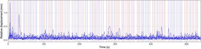 Functional MRI of Native and Non-native Speech Sound Production in Sequential German-English Bilinguals